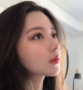 Da mũi mỏng có thực hiện nâng mũi được không