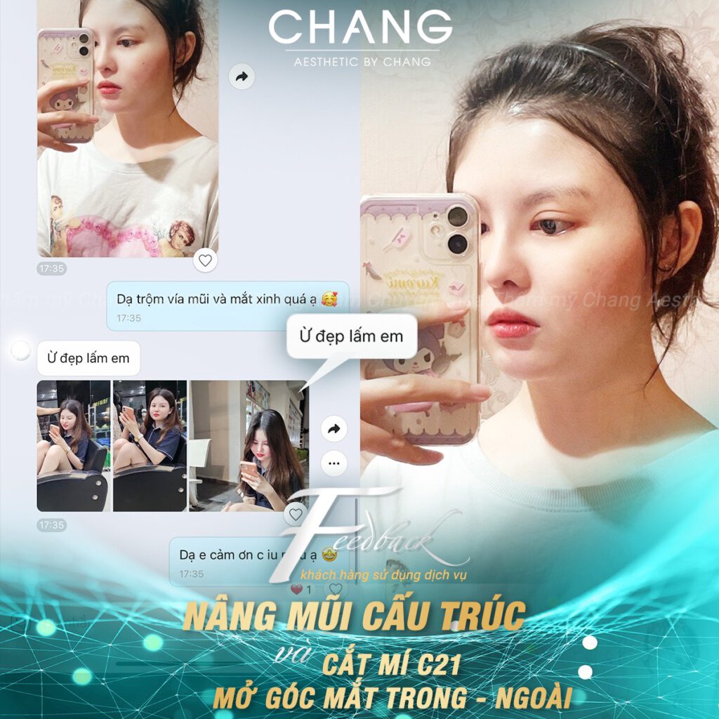 Da mũi mỏng bạn nên tham khảo mũi tự nhiên baby độ bay nhẹ nhàng