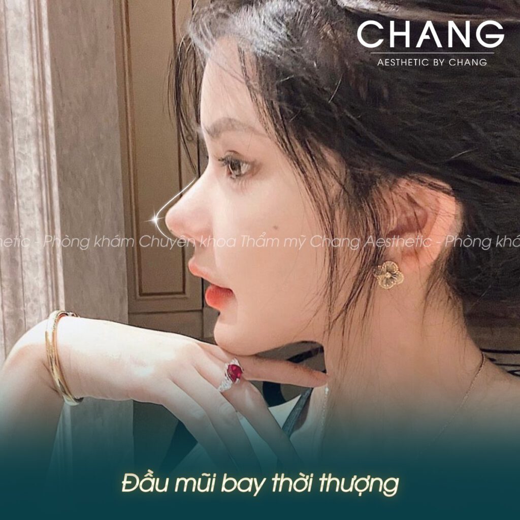 Đầu mũi bay độc đáo, khác biệt