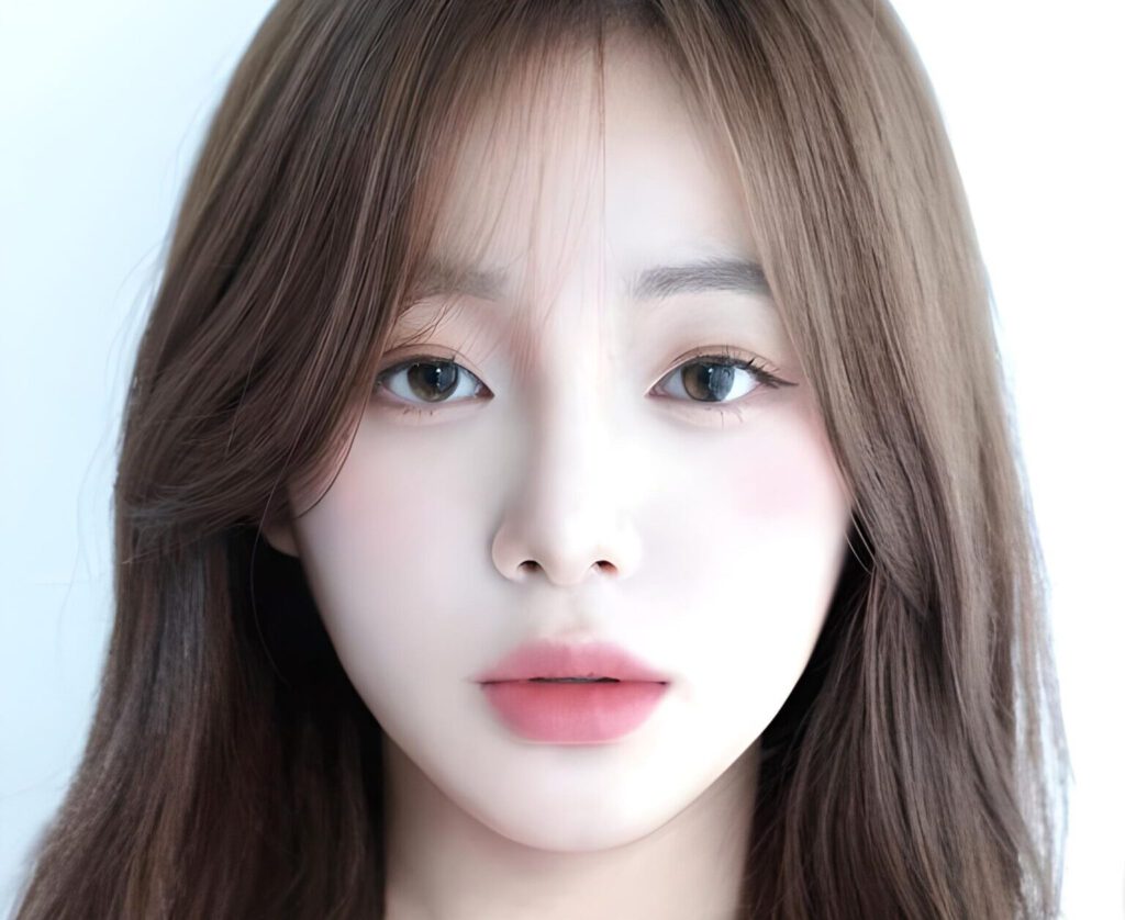 Độn rãnh cười nội soi