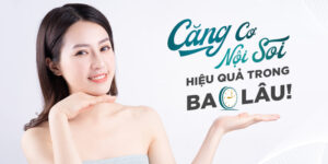 căng cơ nội soi giữ được trong bao lâu