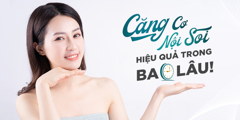 căng cơ nội soi giữ được trong bao lâu