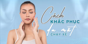 cách khắc phục da mặt bị chảy xệ
