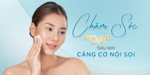 Chăm Sóc Da Sau Khi Căng Cơ Nội Soi