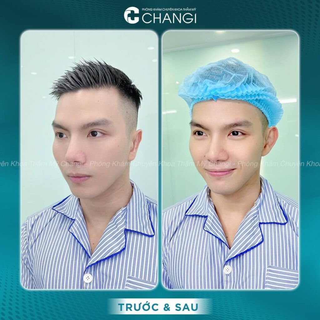 Kể cả nam lẫn nữ đều thăng hạng nhan sắc nhờ tạo hình tai vểnh