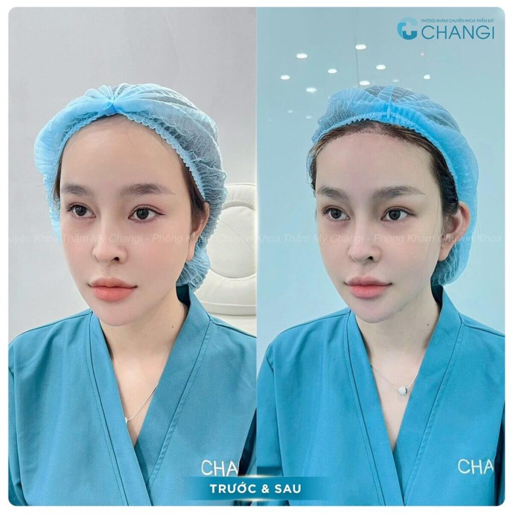 Khách hàng thăng hạng nhan sắc nhờ tạo hình tai vểnh