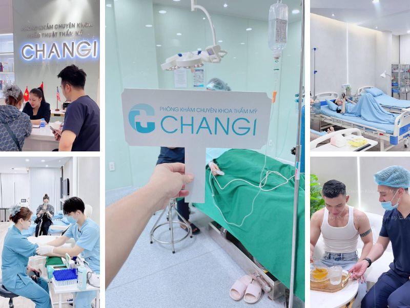 Quy trình tạo hình tai vểnh tại CHANGI