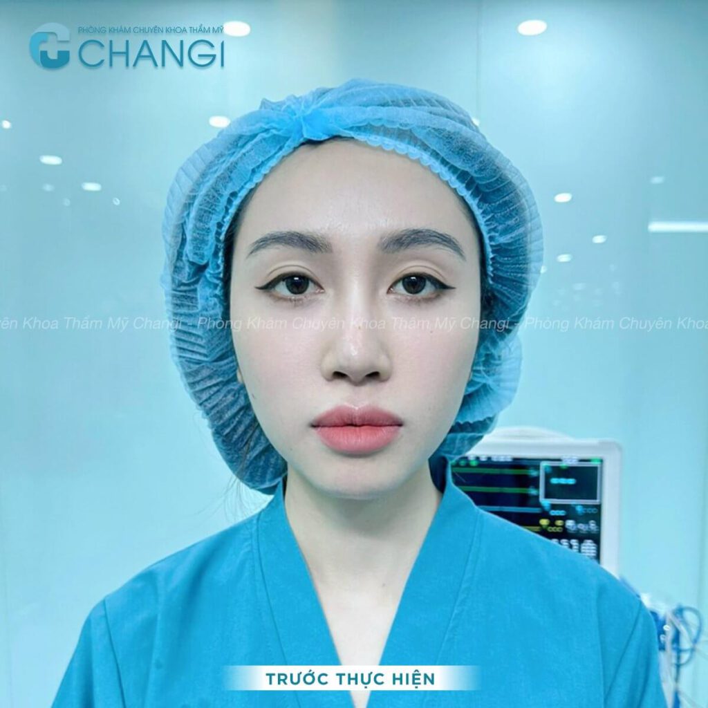 Tai áp sát đầu sẽ khiến khuôn mặt kém duyên