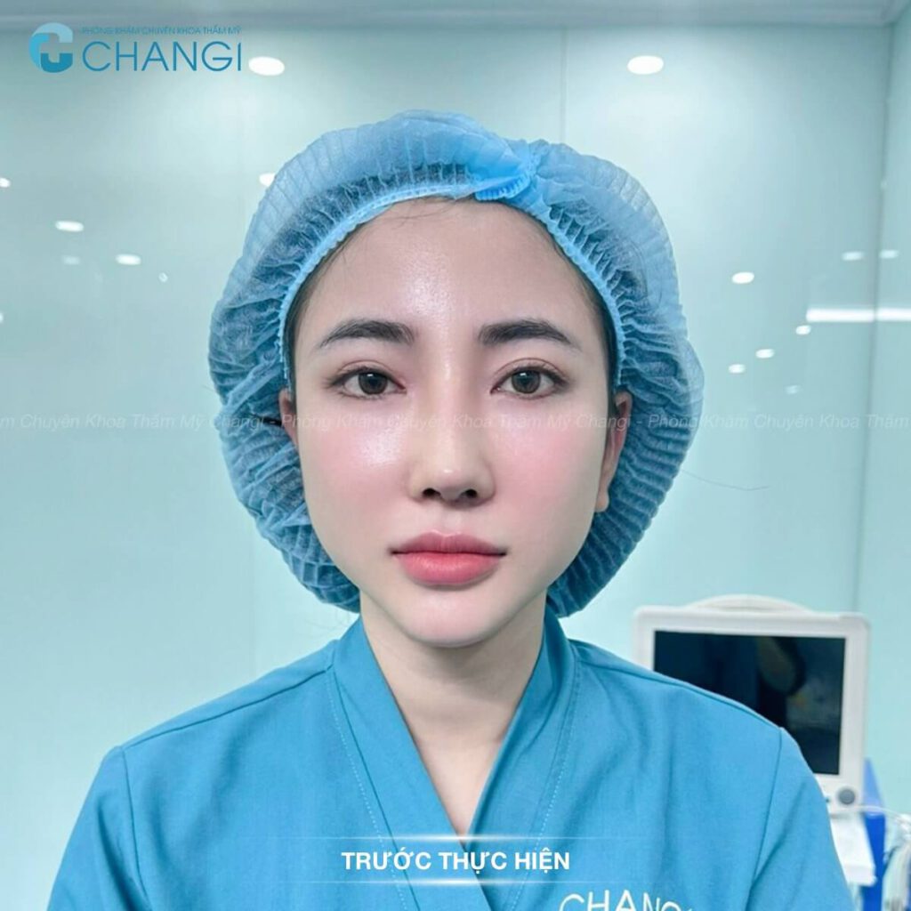 Tai áp sát đầu sẽ khiến khuôn mặt không được hài hòa