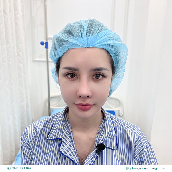 Tai áp sát đầu sẽ khiến khuôn mặt không được thanh tú