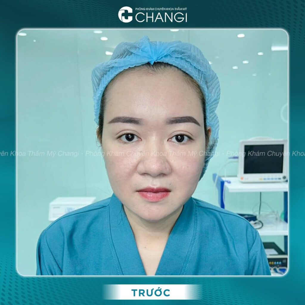 Tai cụp sẽ ảnh hưởng đến tướng số