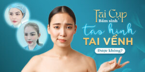 Tai Cụp Bẩm Sinh Phẫu Thuật Tạo Hình Tai Vểnh Được Không?