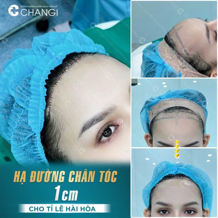 Phục hồi nhanh chóng chỉ sau 7 ngày