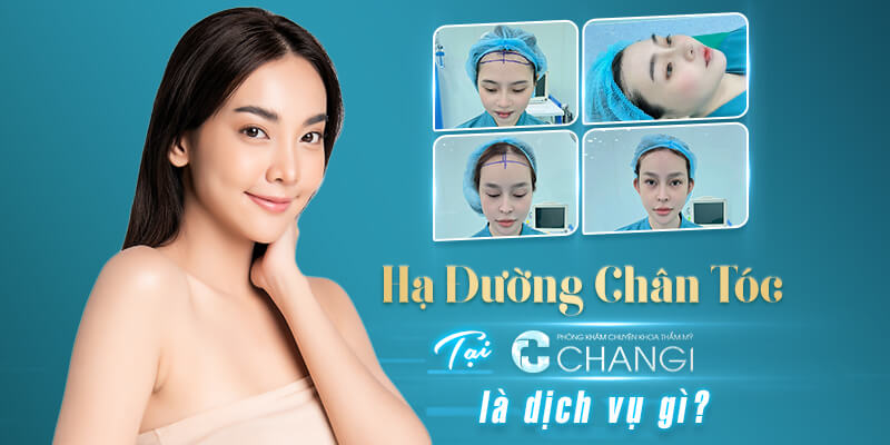 Hạ Đường Chân Tóc