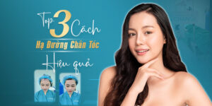 Top 3 Cách Hạ Đường Chân Tóc Hiệu Quả Nhất 2023