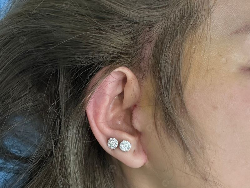 Đường may căng da mini plus tại CHANGI