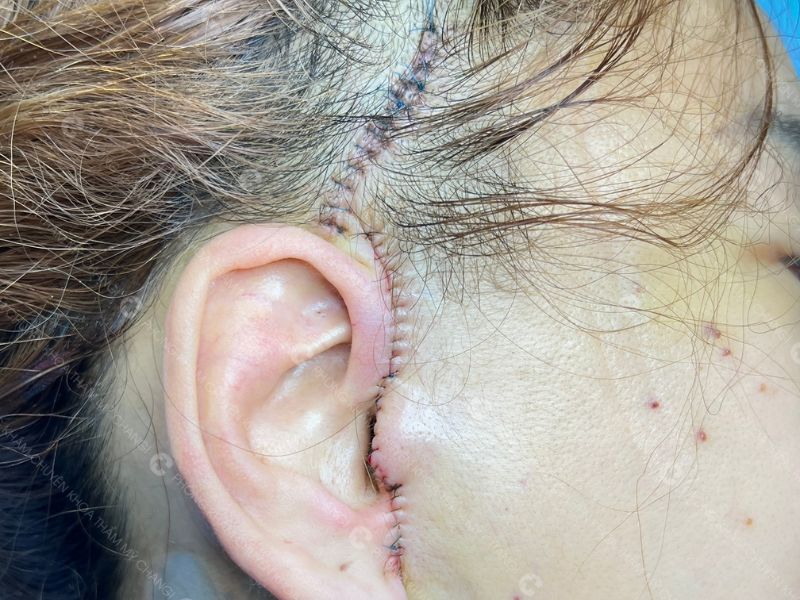 đường may căng da mini plus