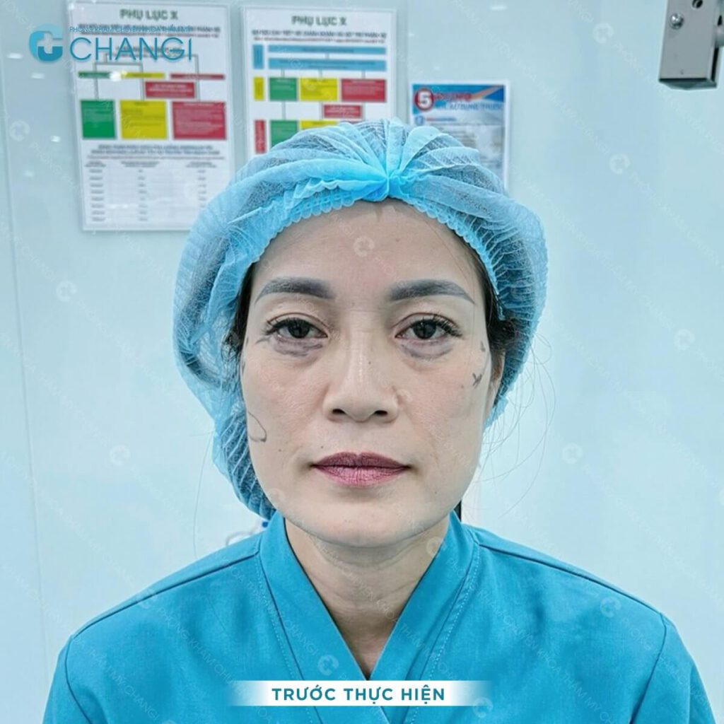 Gương mặt khách hàng đang có dấu hiệu lão hóa