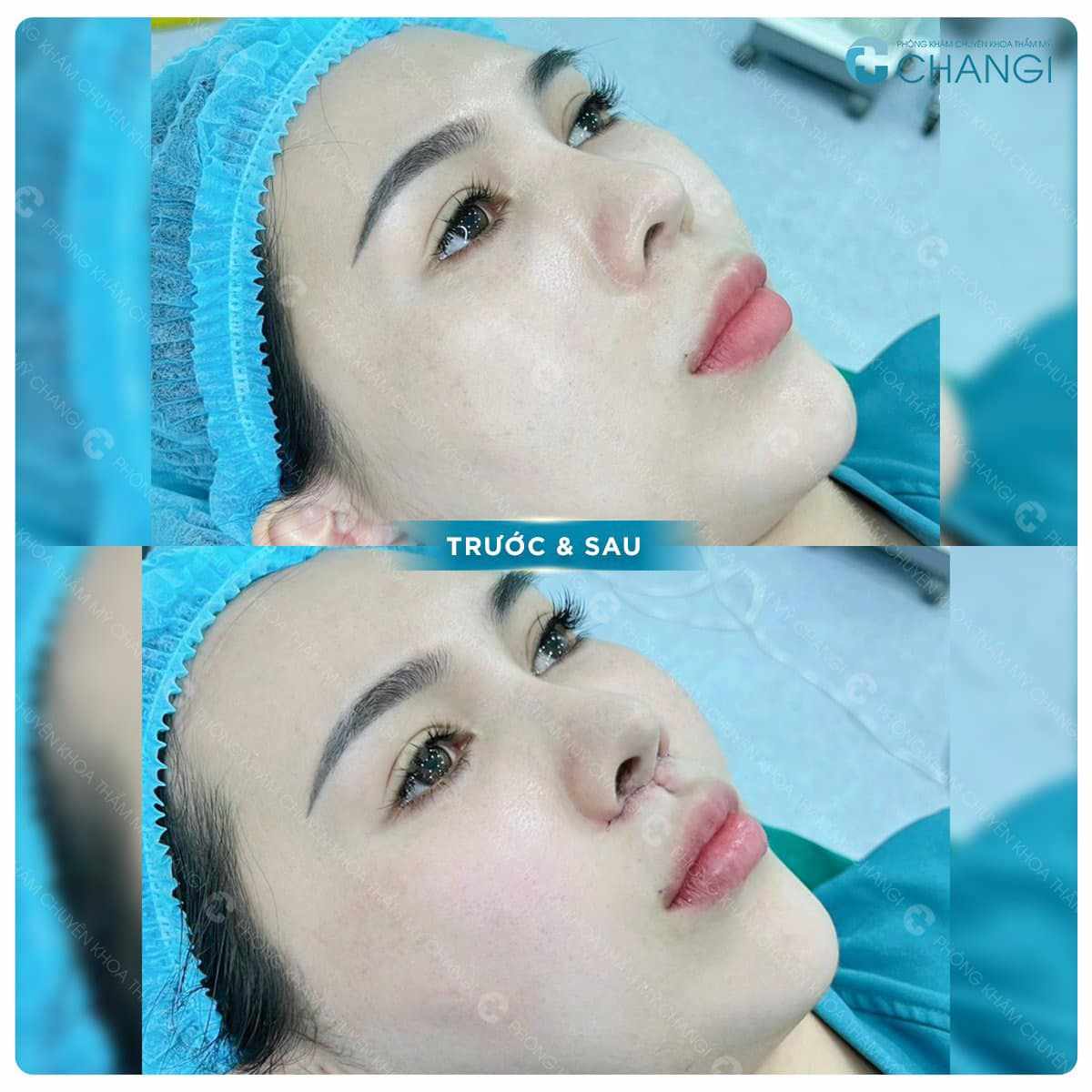 Khách hàng mới thực hiện xong