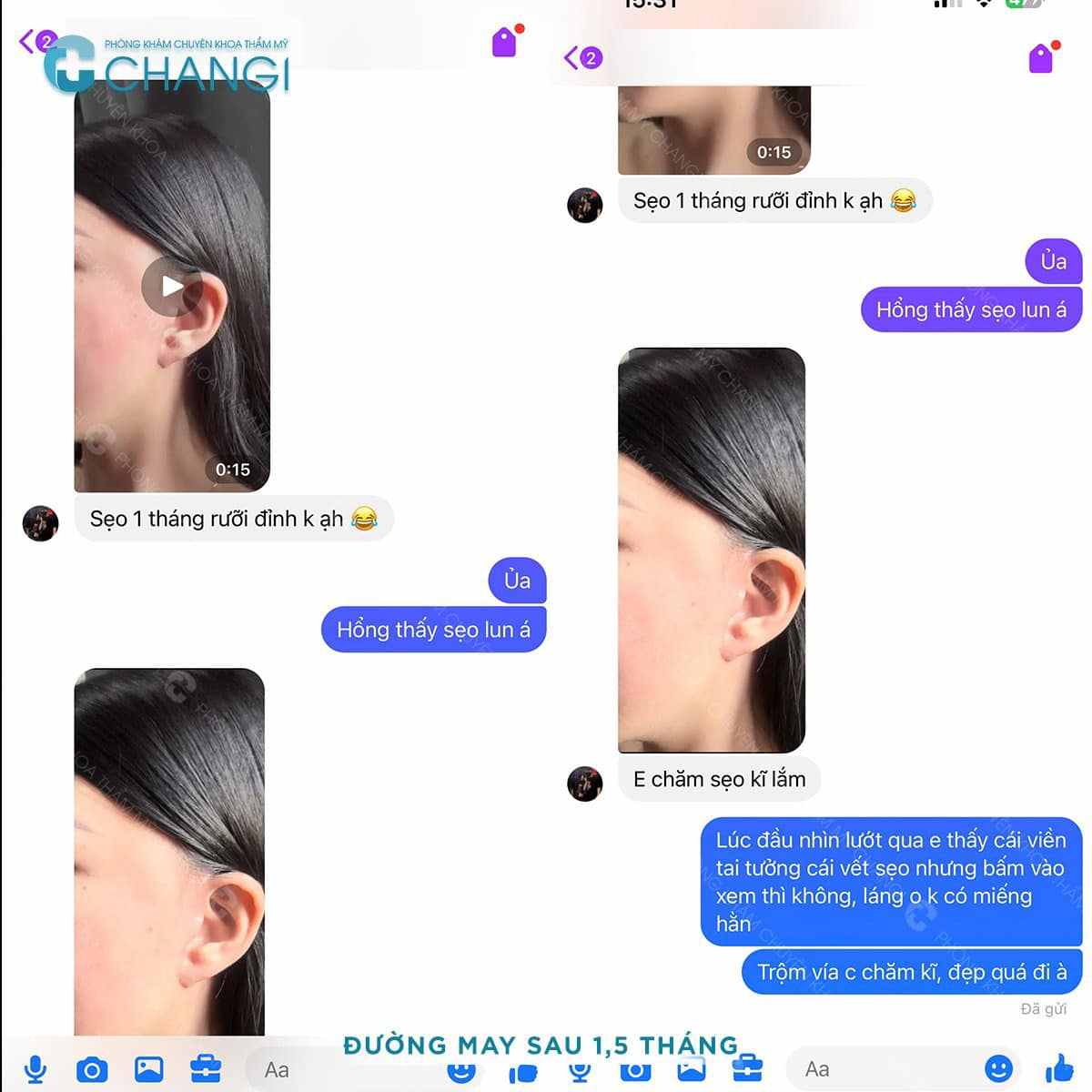 Phản hồi khách hàng sau khi thực hiện căng da tại Changi