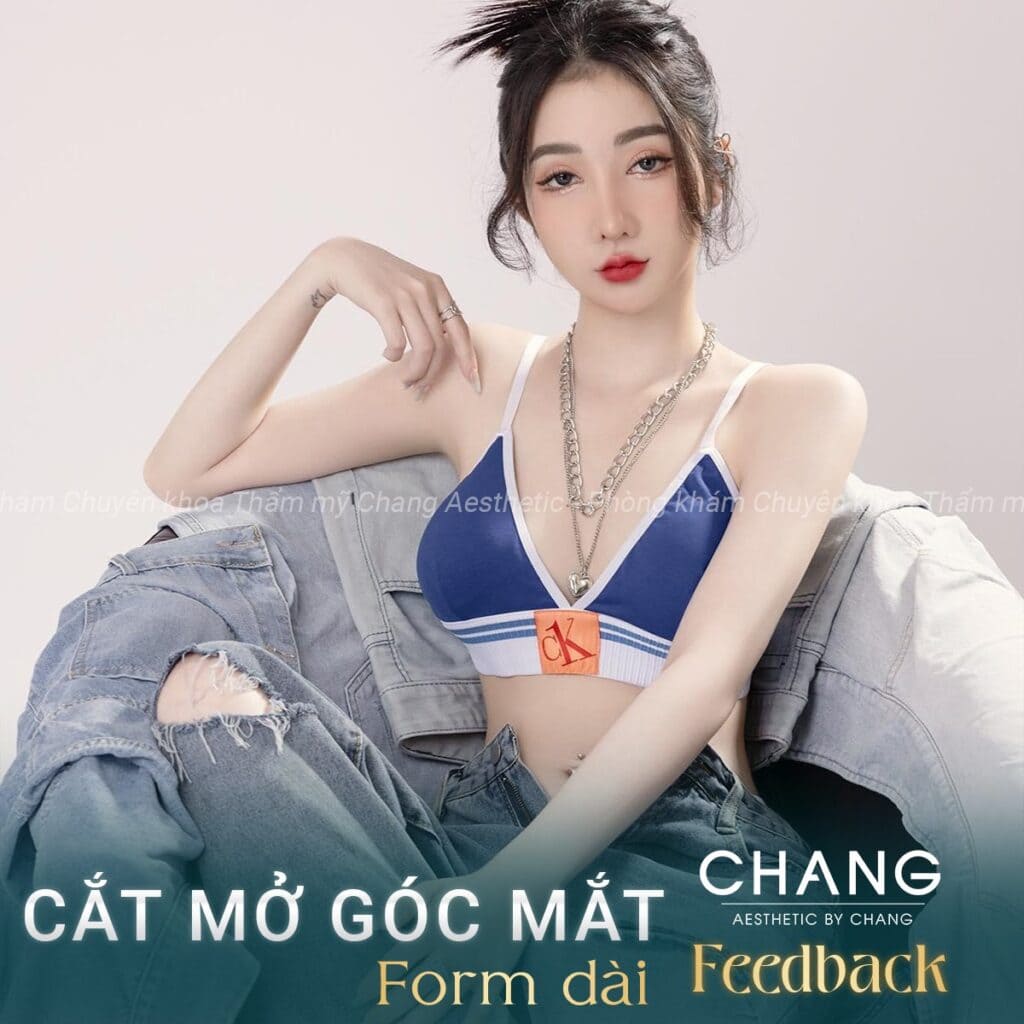 Phòng khám Changi - Đơn vị uy tín hàng đầu trong thẩm mỹ mở rộng góc mắt