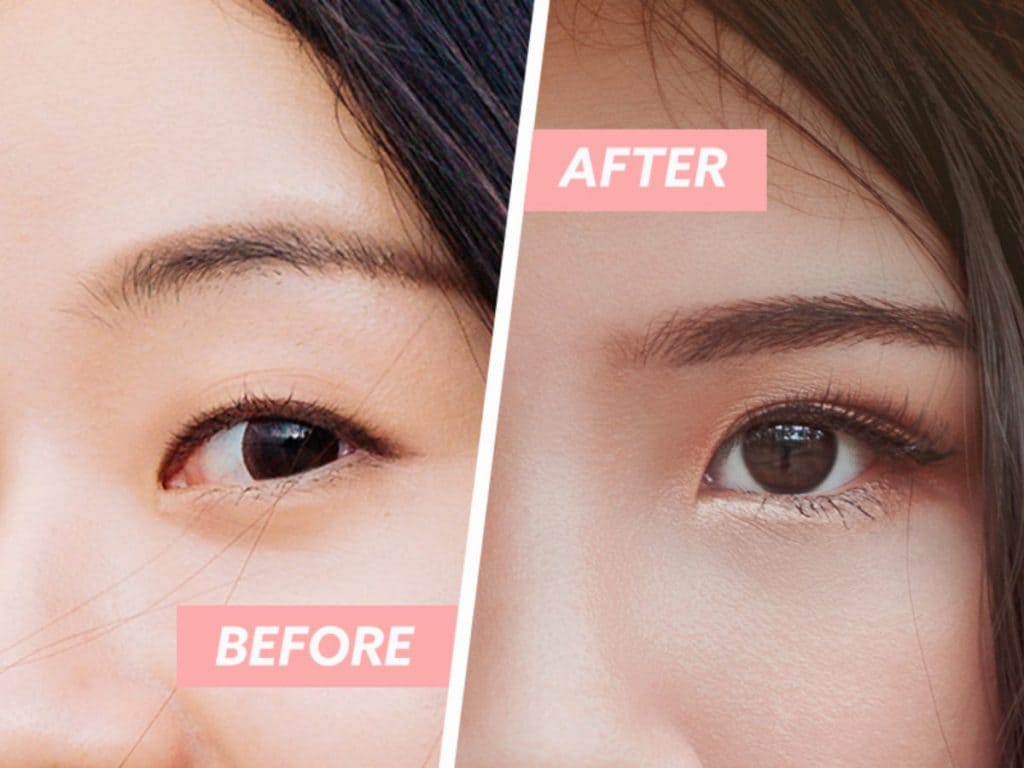 Mở góc mắt là phương pháp thẩm mỹ giúp đôi mắt trở nên dài hơn, có chiều sâu và quyến rũ hơn