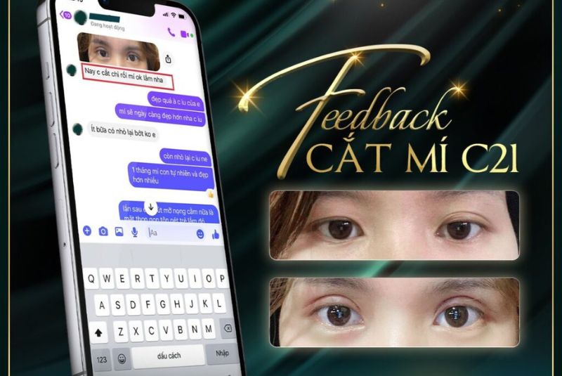 Dịch vụ mở góc mắt của Changi được nhiều khách hàng đánh giá cao về chất lượng, độ thẩm mỹ