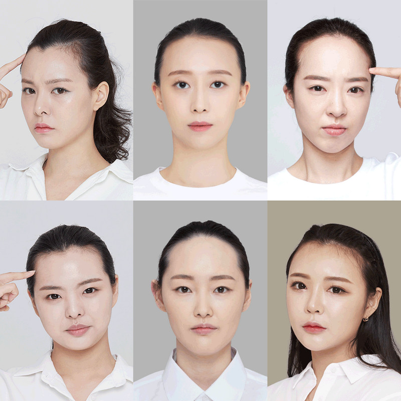 Kiểu khuôn mặt cần cải thiện khi có trán cao