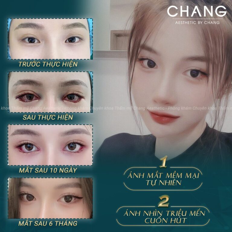 Tuân thủ các hướng dẫn chăm sóc mắt từ bác sĩ để có đôi mắt đẹp tự nhiên theo thời gian