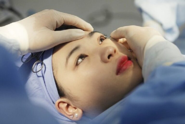 Quy trình thực hiện phẫu thuật mắt xếch đúng chuẩn y khoa
