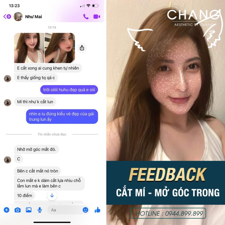 Khách hàng hài lòng với kết quả thẩm mỹ ngoài mong đợi