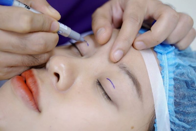 Bạn cần xem xét thời gian phục hồi cũng như những rủi ro sau phẫu thuật