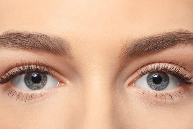 Sửa mắt xếch với phương pháp cắt 2 mí giúp mắt đẹp tự nhiên, cân đối, to tròn