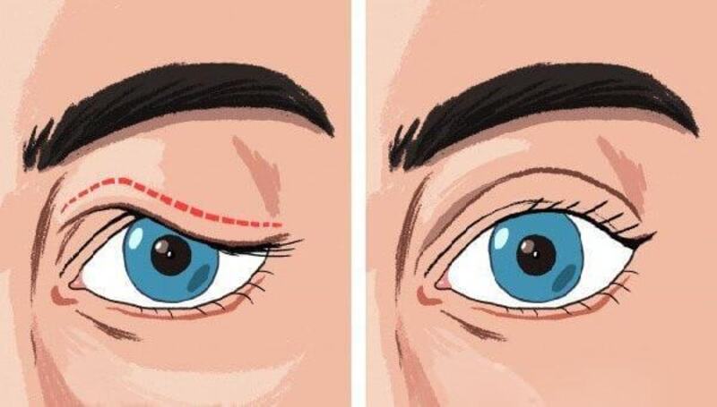 Bảo vệ mắt trước mọi nguy cơ ảnh hưởng tới khả năng gây sụp mí