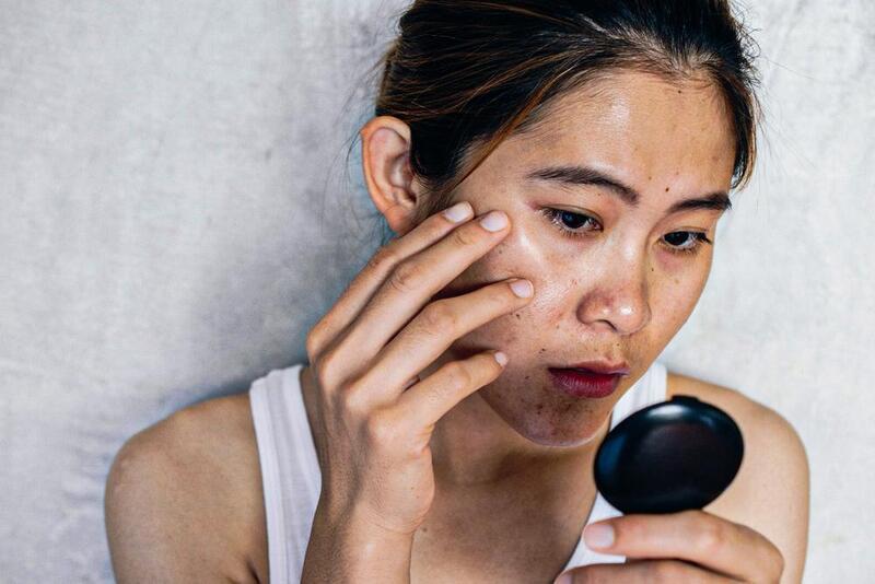 Chế độ sinh hoạt thiếu lành mạnh khiến làn da dần lão hoá