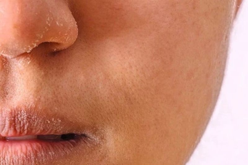 Dấu hiệu nhận biết lão hoá sớm trước 30 tuổi