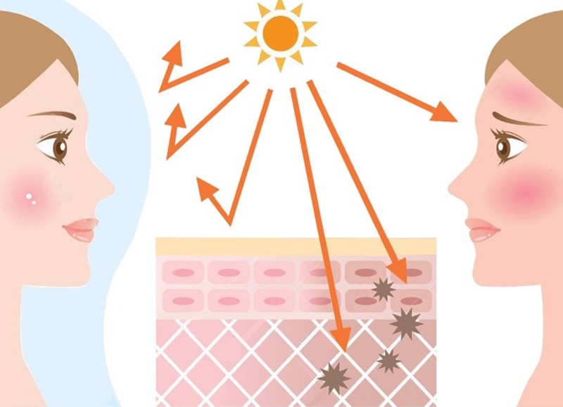 Lão hoá sớm do tác động từ ánh nắng mặt trời, tia UV
