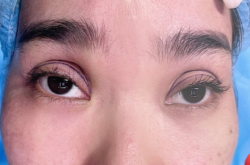 Nên quay lại gặp bác sĩ ngay khi có các dấu hiệu đau đớn, khó chịu