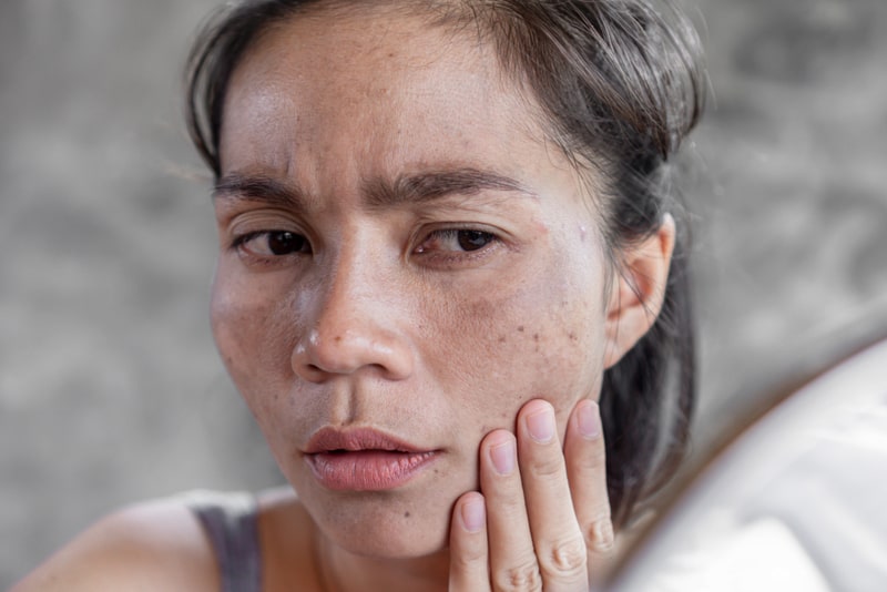 Nguy cơ lão hoá do thức khuya và căng thẳng kéo dài